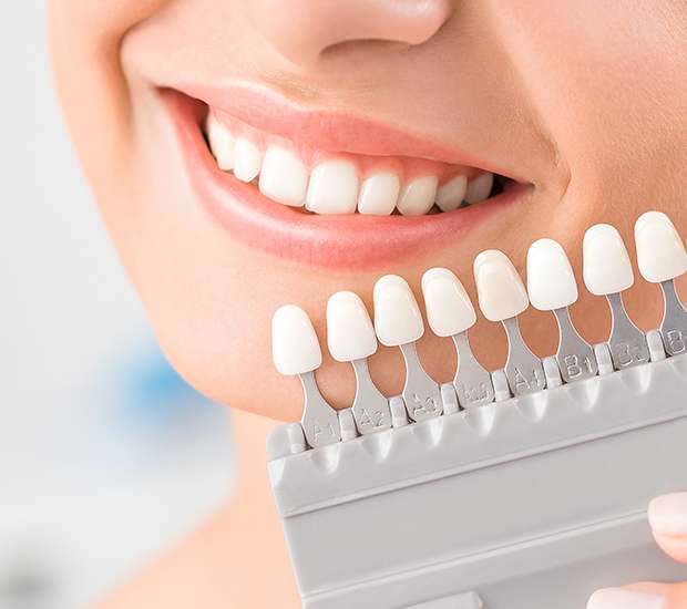Norwood Dental Veneers and Dental Laminates