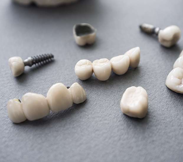 Norwood The Difference Between Dental Implants and Mini Dental Implants