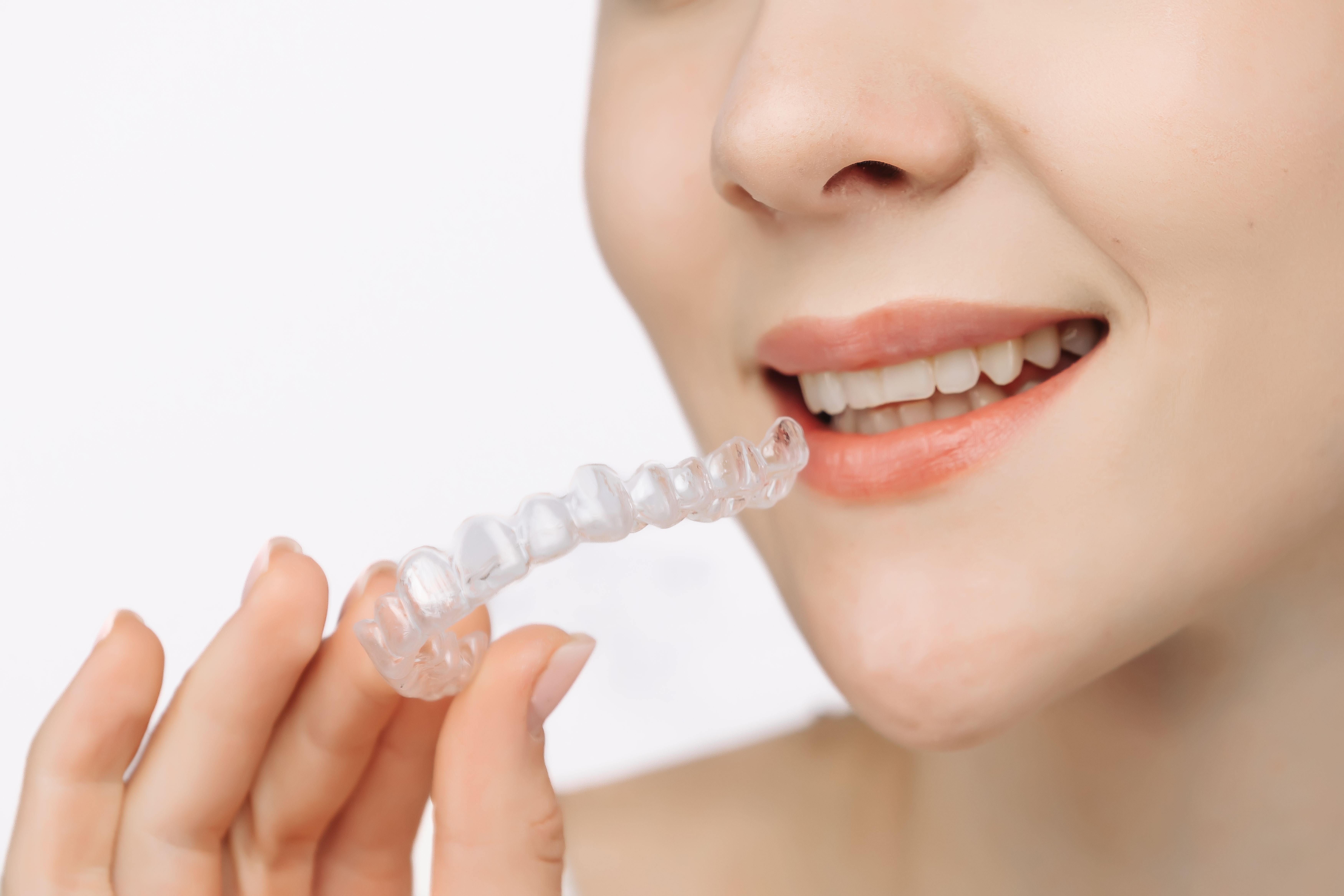 Questions To Ask An Invisalign Dentist